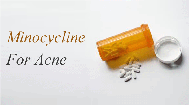 minocycline yellow teeth stain