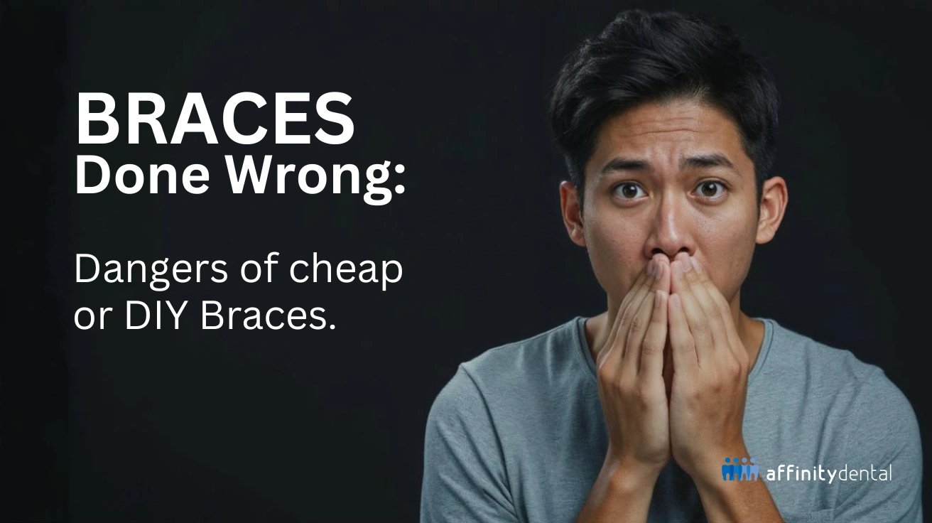 Worried young man covering his mouth with hands, symbolizing the dangers of cheap braces or DIY braces treatment.
