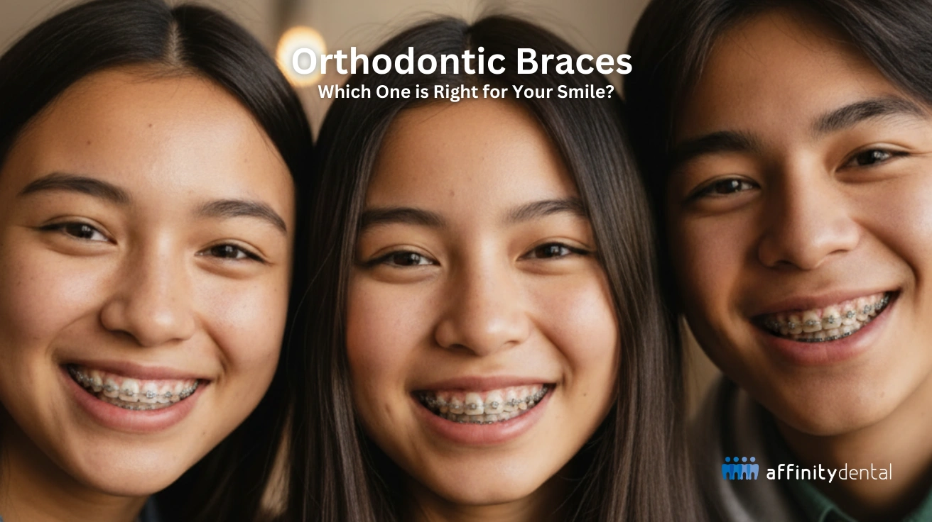 Three smiling Asian teens wearing different types of braces, showcasing orthodontic treatment options