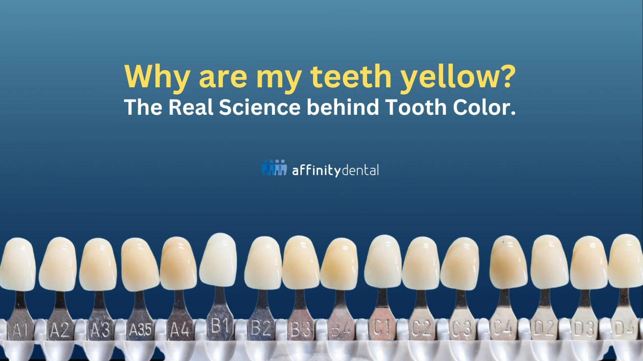 Dental shade guide showing natural variations in tooth color, used in Affinity Dental Clinics’ article on why teeth appear yellow