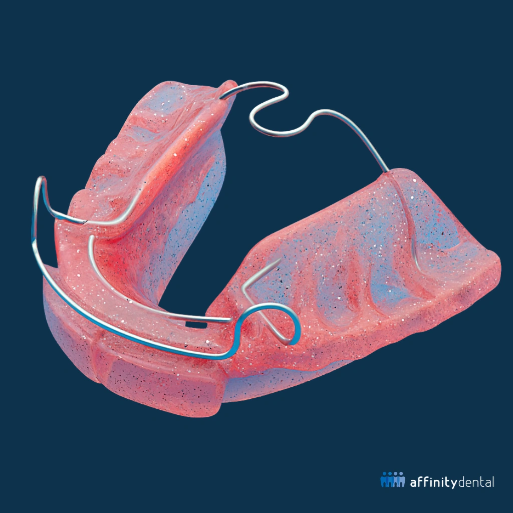 3D illustration of a Bionator orthodontic appliance in soft pink acrylic with wire components on a blue background