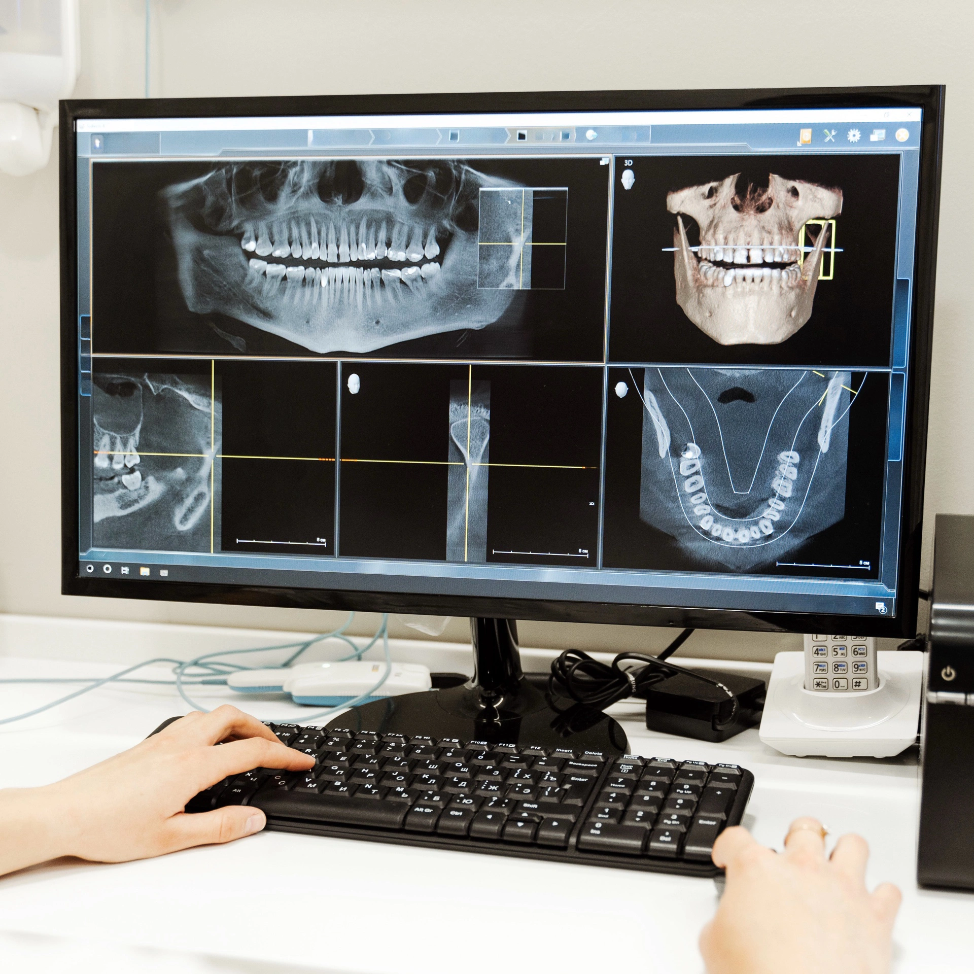 Computer screen displaying digital dental X-rays and 3D scans of a patient’s teeth and jaw.