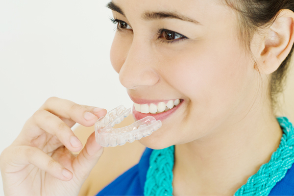 Life After Braces: Why Choose Clear Retainers?