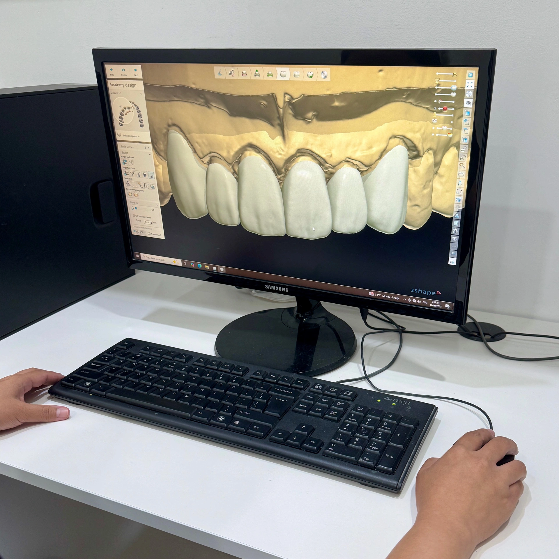 A 3Shape software screen showing digital smile design for customized dental restorations at Affinity Dental Clinics.