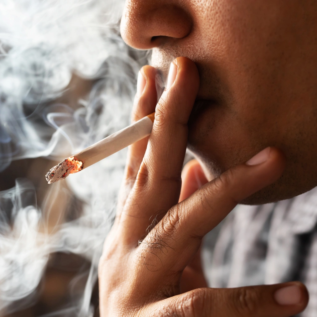 Close-up of a person smoking a cigarette, highlighting smoking as a risk factor for dental implant failure. 
