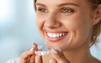 13 Things to Know Before You Get Invisalign