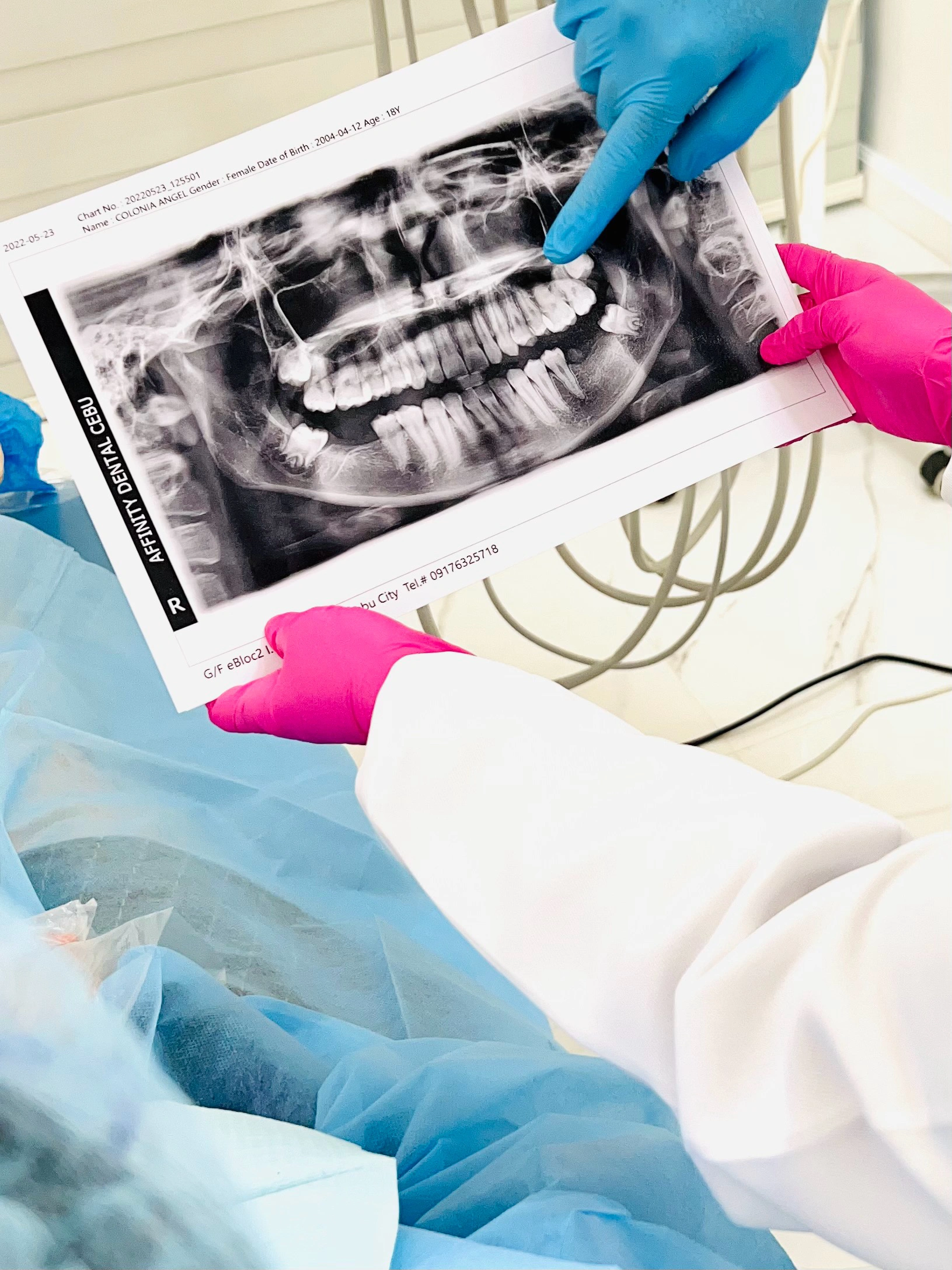 Dentists at Affinity Dental Clinics Cebu reviewing a patient’s panoramic X-ray for diagnosis and treatment planning.