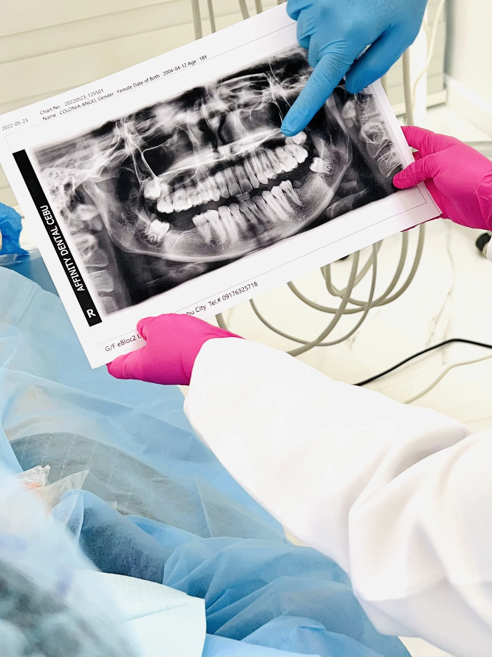 Panoramic, cephalometric, and periapical X-ray equipment at Affinity Dental Clinics Cebu