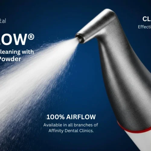 AIRFLOW® dental cleaning handpiece spraying air, water, and powder for gentle biofilm and stain removal at Affinity Dental Clinics