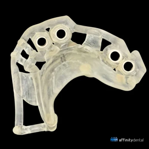 Transparent 3D printed surgical guide with multiple sleeves for guided dental implant placement